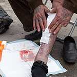 April 25, 2020, Moscow, Russia: First aid for a homeless person.